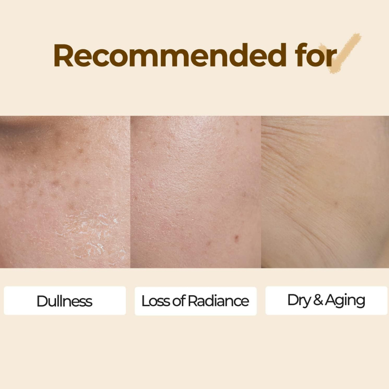 Recommendations